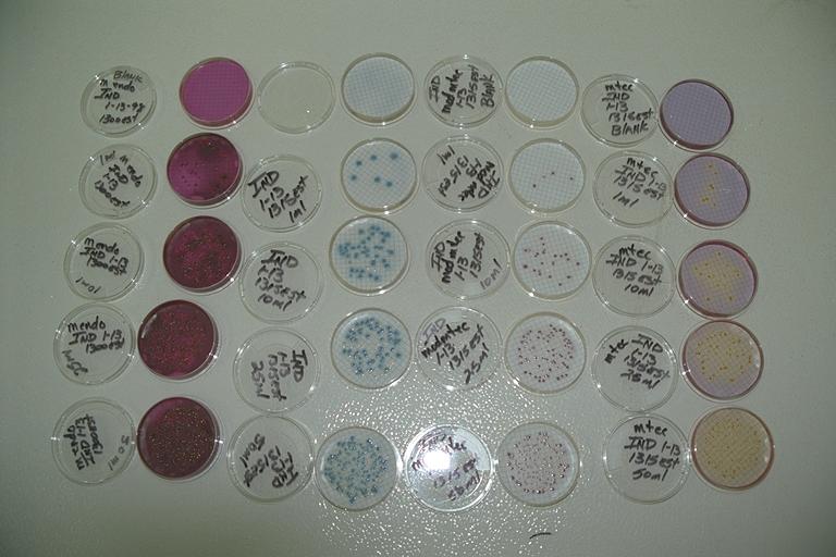Bacteria Plates after Incubation.